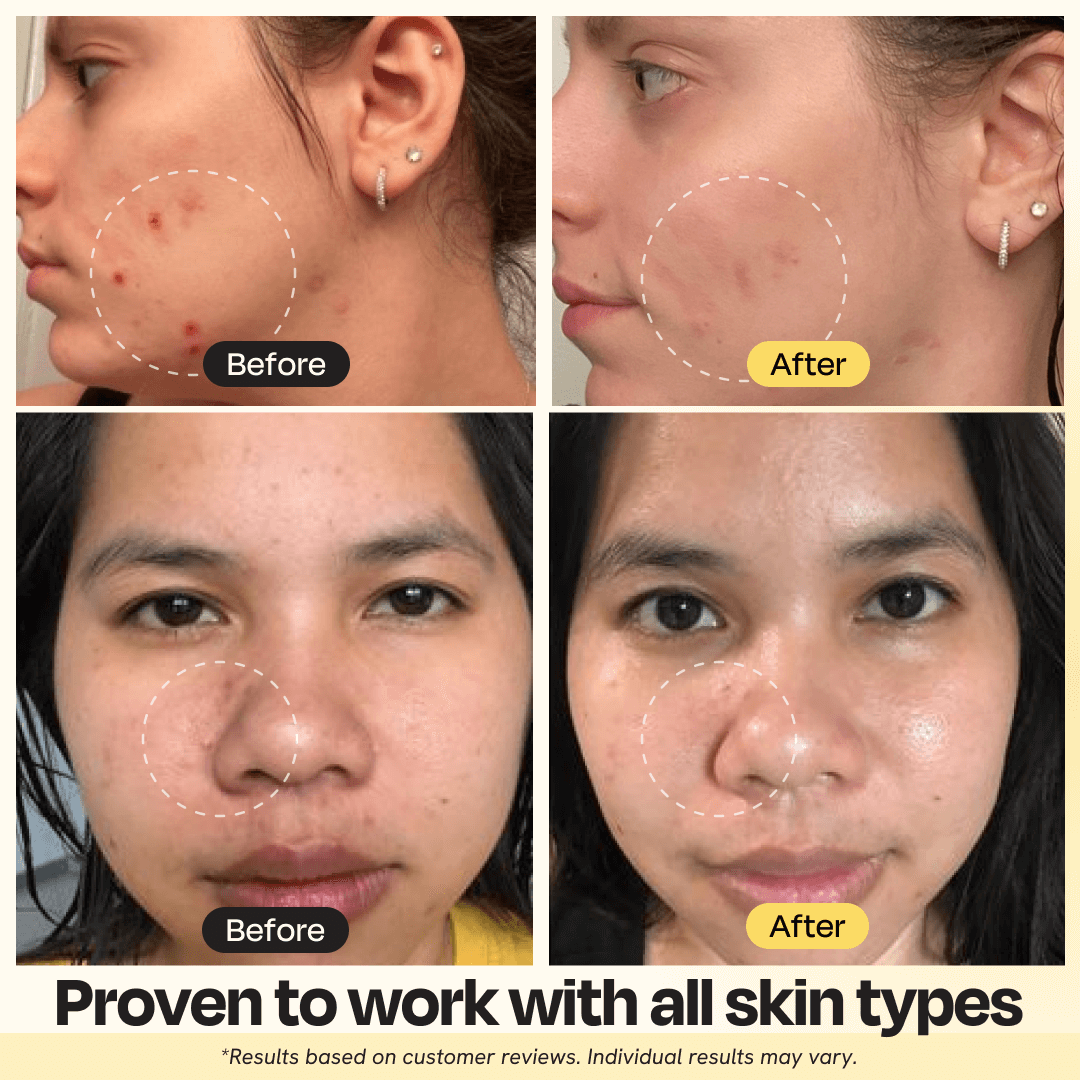 Mascarilla de arcilla con vitamina C